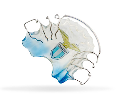 Ortodonzia-rimovibile-02