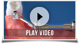 chirurgia-dentale-video
